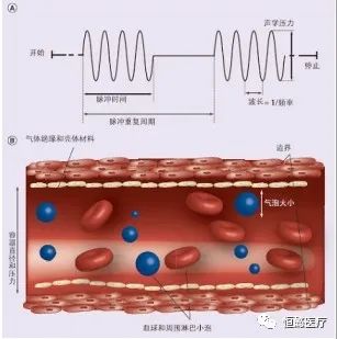 超声联合微泡技术在肿瘤治疗中的研究进展
